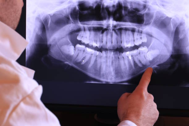 Best Emergency Treatment for Dental Infections or Abscesses in Kula, HI